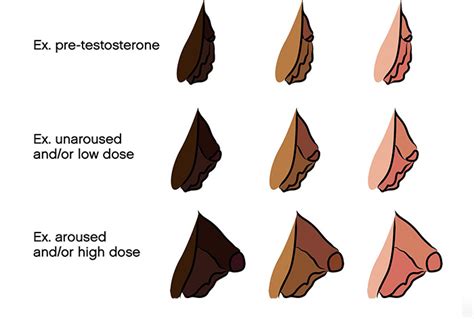 FTM Bottom Growth: A Guide from Female